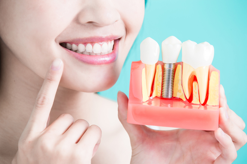 Trồng Răng Implant