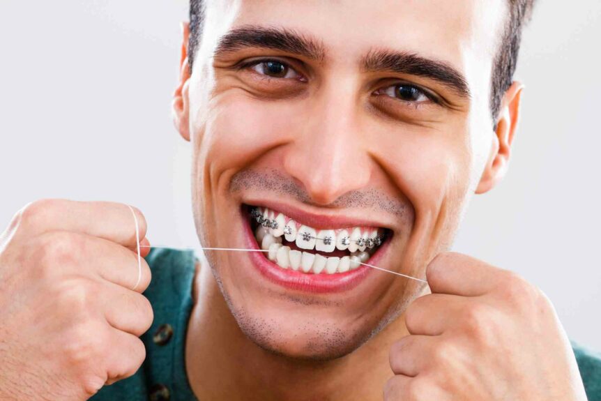 Niềng Răng Thẩm Mỹ